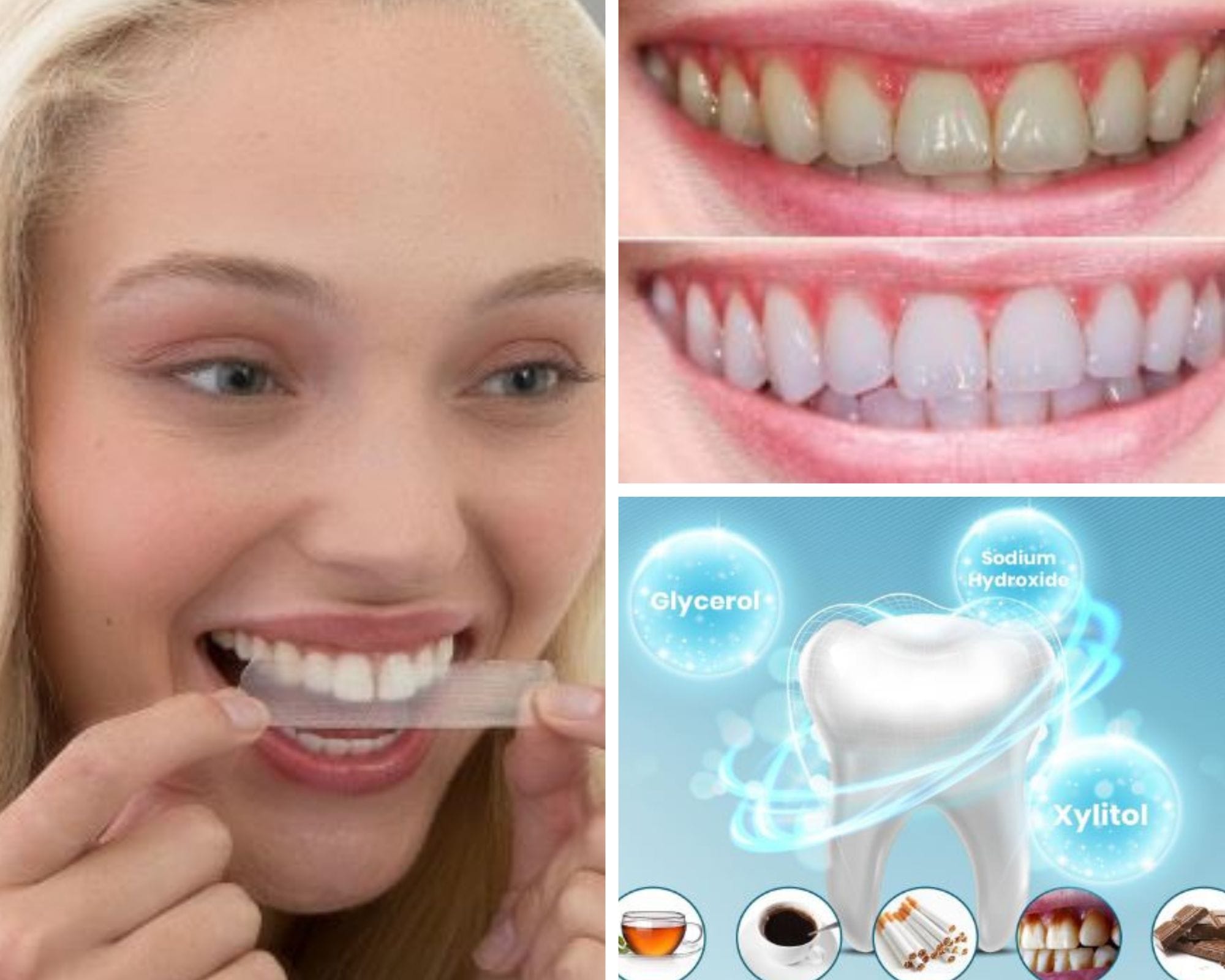 Check Out Teeth Whitening and Let Your Smile Shine Through!