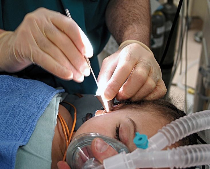 Best Earwax Removal Kits to Keep Your Ears from Unwanted Symptoms!